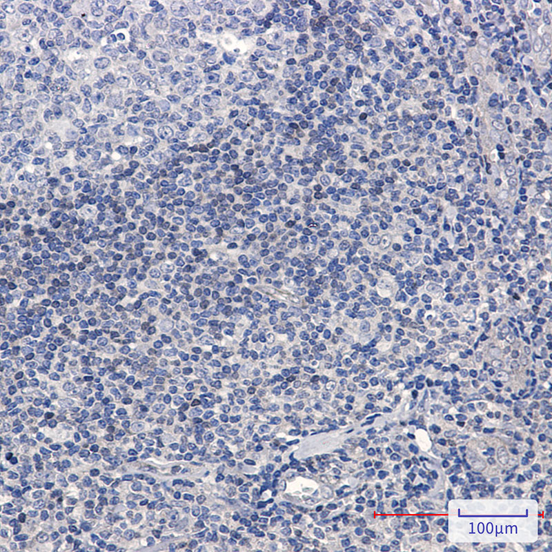 ADK Rabbit mAb